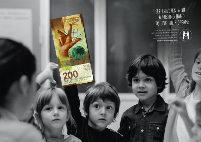 Give Children a Hand: Help children with a missing hand, 5