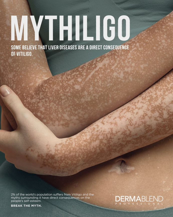Dermablend: Mythligo, 2