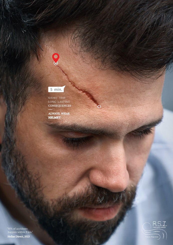 R.S.I. - Road Safety Institute: Scars, 2