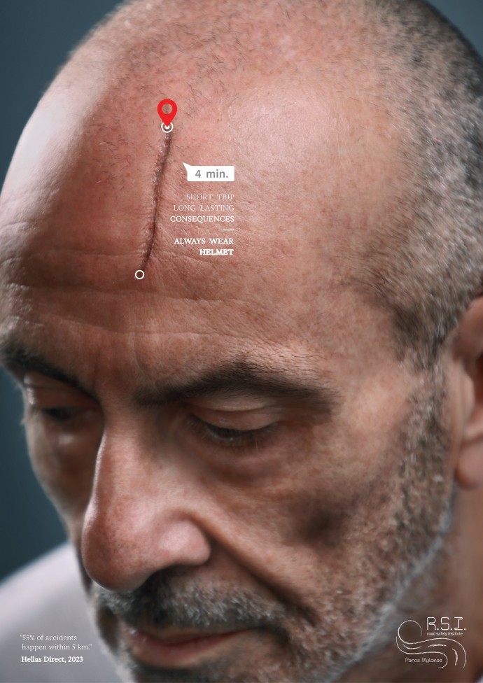 R.S.I. - Road Safety Institute: Scars, 3