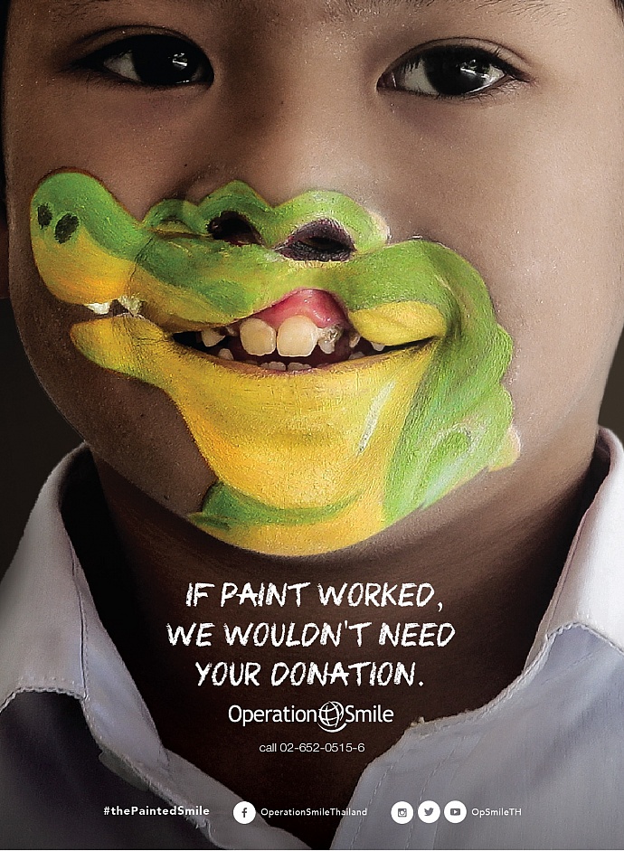 Operation Smile: Crocodile